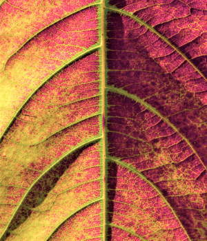 抗リン脂質抗体症候群　血栓症