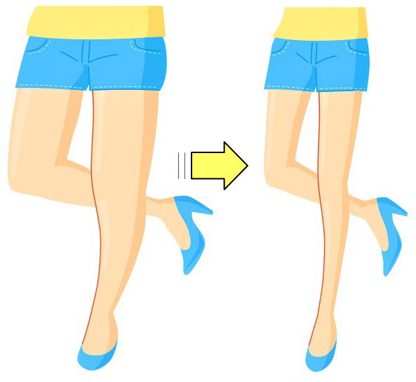 糖尿病　運動療法